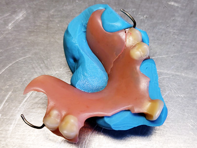 réparation prothèse dentaire à Fosses-la-Ville