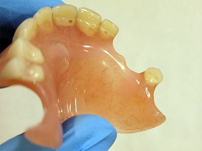 réparation dentier à Sambreville